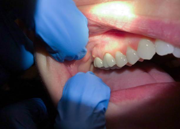 Best Mobile Emergency Dentist in Hrison, AR